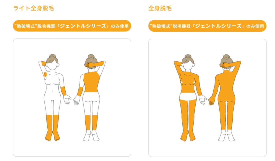 ルシアクリニック公式のライト全身脱毛と全身脱毛の照射範囲のイラスト